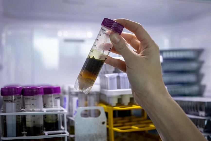 Forum UK/Hynek Glos: Protiparazitní léčiva nejsou pro člověka toxická. Mohou ale zabíjet v půdě volně žijící bezobratlé organismy a další živočichy jako třeba žížaly.