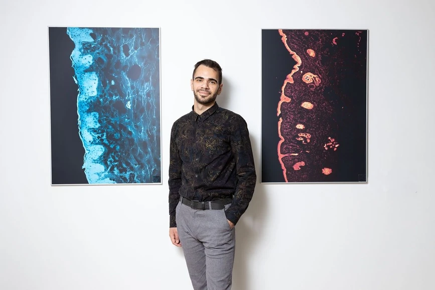 Forum: magazín Univerzity Karlovy/Michal Novotný: Společná cesta k patentu: Jak UK a Contipro tvoří inovace