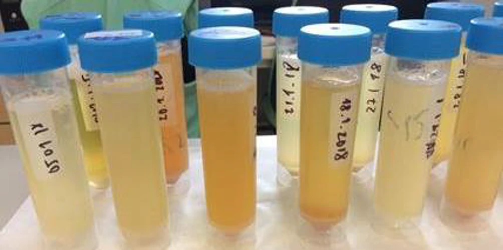 RADANAL: Obrázek 1: Vzorky moči analyzované FIA-ECD.