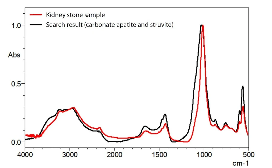 Shimadzu: Obr. 3 Infračervené spektrum vzorku ledvinového kamene (červená) a výsledek vyhledávání v knihovně (černá)